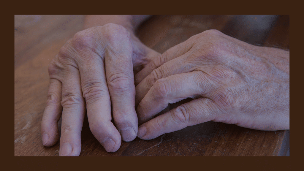 psoriatic arthritis