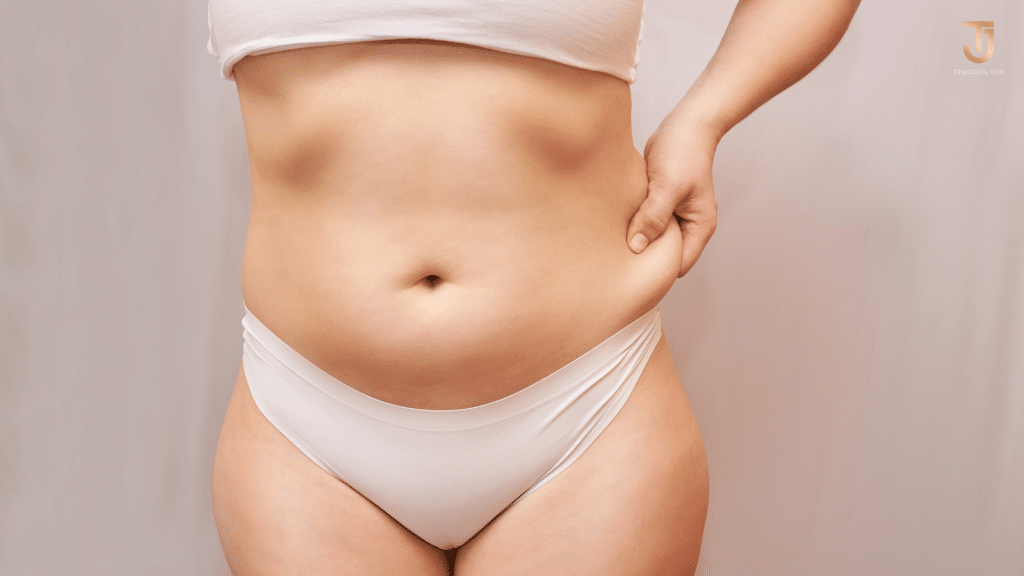 Liposuction procedure