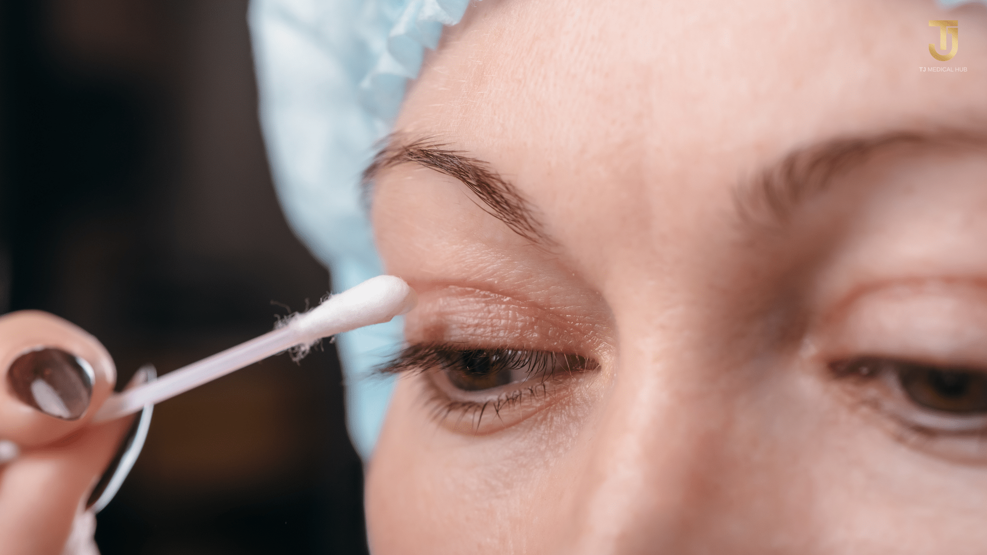 Cost of Eyelid Surgery in Thailand