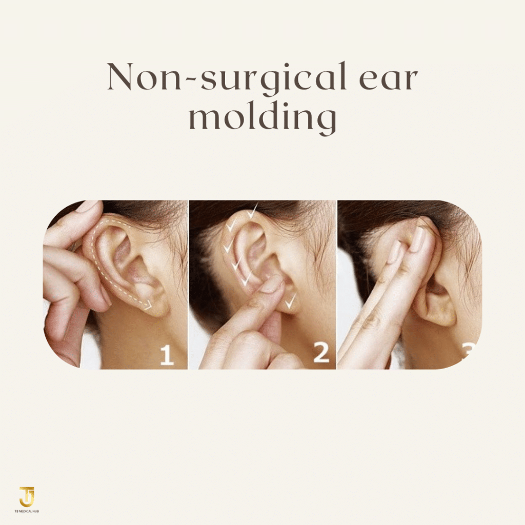 Non-surgical ear molding